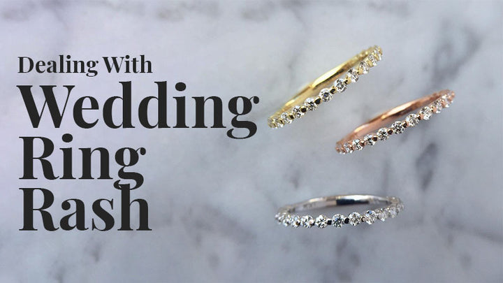 Wedding Ring Rash: Symptoms & What to Avoid – Honey Jewelry Co