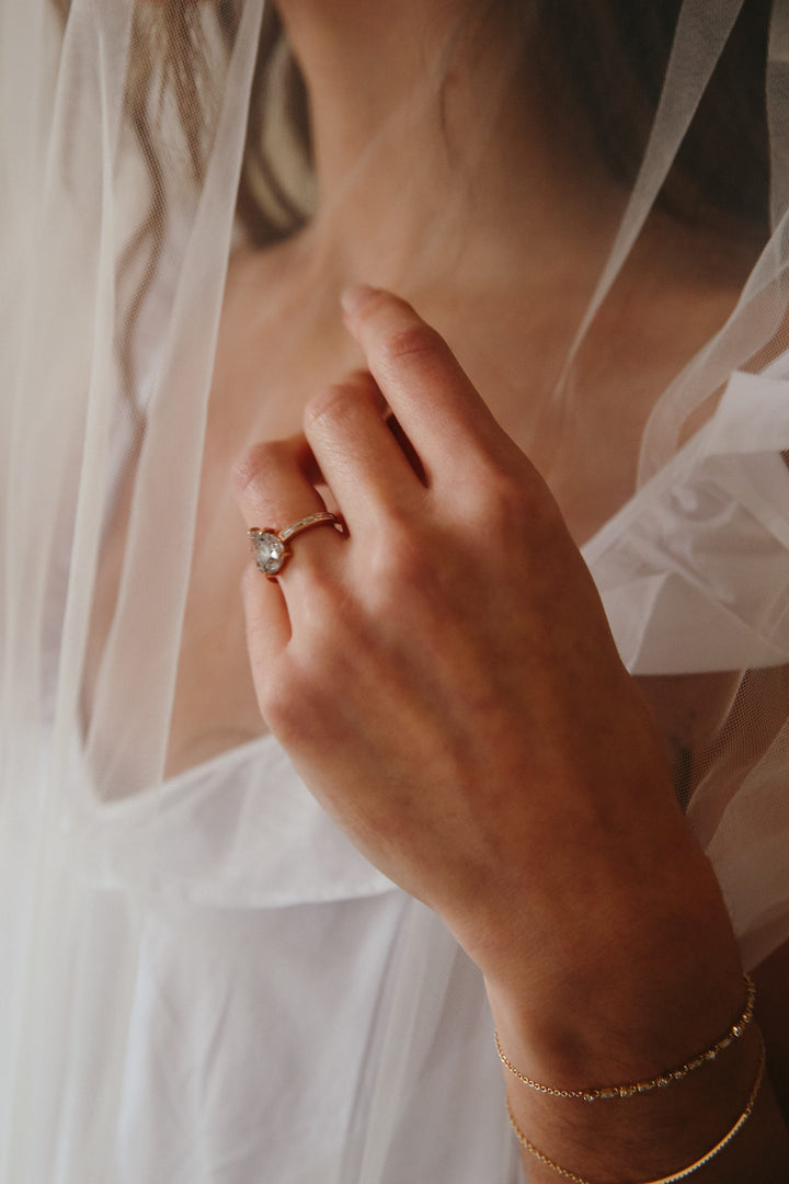 Wedding Ring Rash: Symptoms & What to Avoid – Honey Jewelry Co